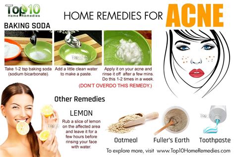 home remedies  acne top  home remedies