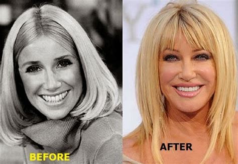 Plastic Surgery Before And After July 2014