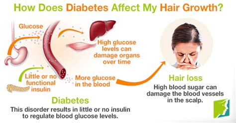faqs how does diabetes affect my hair growth