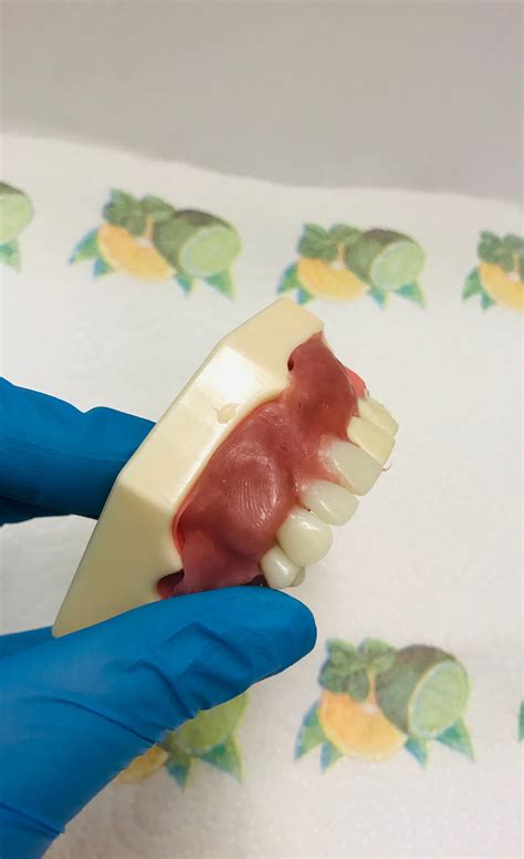 Diy Denture Kit Basic Immediate Partial Denture Full Etsy