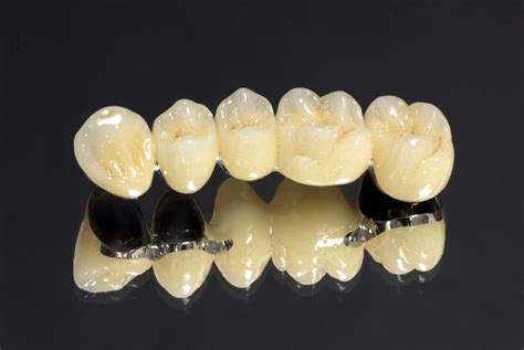 full ceramic  ceramic crowns dr nechupadam dental clinic