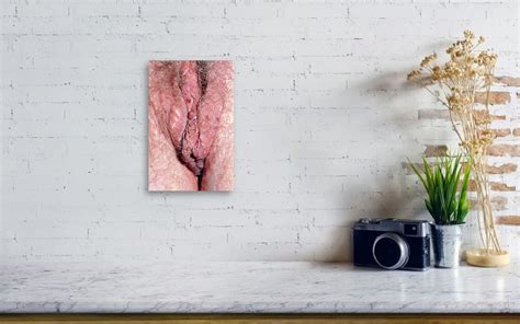 sebaceous cysts on vulva canvas print canvas art by dr h c robinson