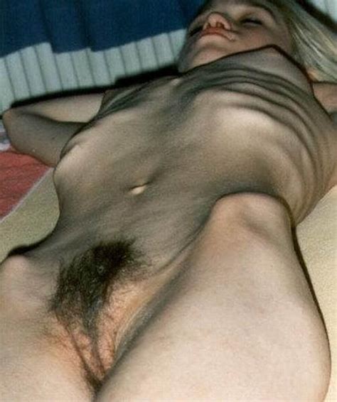 hairy anorexic pussy xxx photo