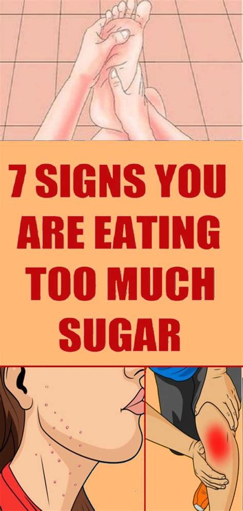 7 Signs You’re Eating Too Much Sugar Healthy Logy