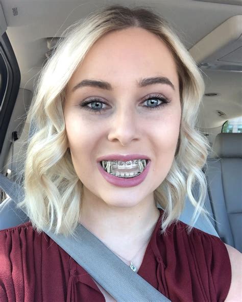 Angry Girl With Dental Braces Xxx Porn