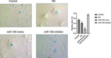 frontiers mir 155 regulates the proliferation of glioma cells through