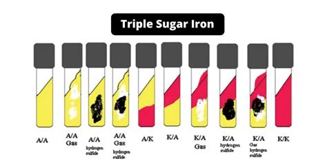triple sugar iron tsi  composition principle preparation results