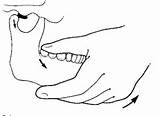 Temporomandibular Dysfunction Cervical Spine sketch template