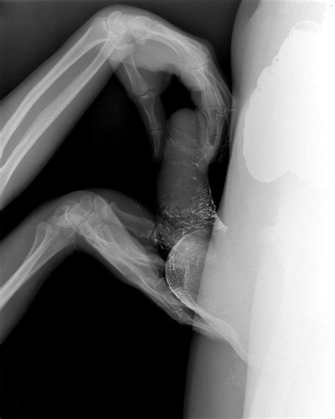x ray porno mega dildo insertion
