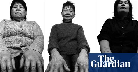 the scarred hands of filipino maids in pictures art