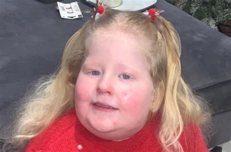 This 5 Year Old Cant Stop Eating Thanks To A Rare Genetic Disease You