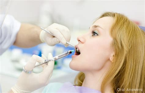 dental anesthetic    heart beat faster oral answers