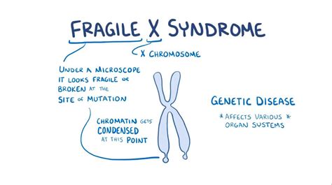 Fragile X Syndrome Video Anatomy And Definition Osmosis