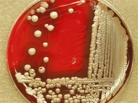 bacillus cereus bacillus cereus colonies  blood  fol flickr