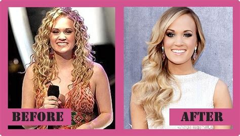 Carrie Underwood Plastic Surgery Did She Get Plastic Surgery