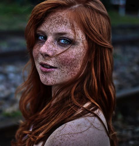 freckles  face pictures   images illnesseecom