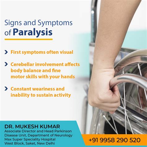 paralysis treatment  delhi paralysis specialist doctor  delhi