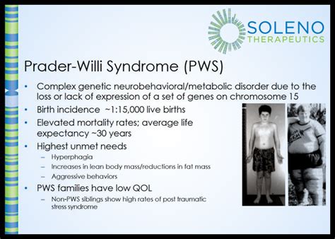 Dwindling Prader Willi Syndrome Drug Development Landscape And Hopeful