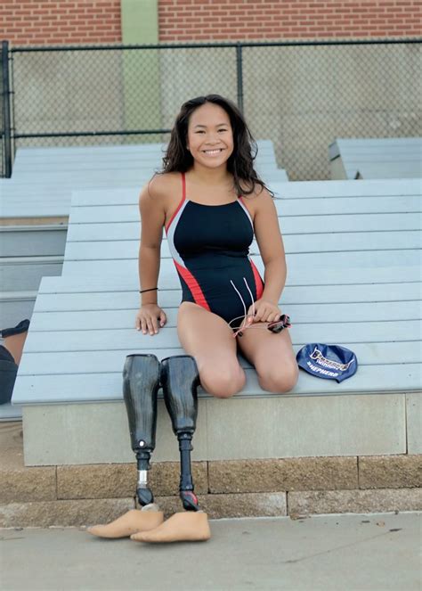 Amputee Teen Left Without Legs After Surviving Suicide