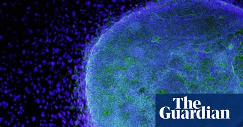 stem cells great expectations stem cells the guardian