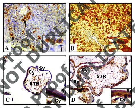 immunohistochemical analysis  furin expression  observed    scientific