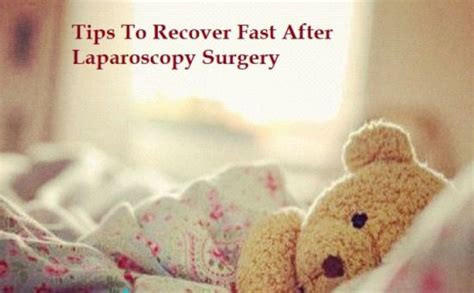 Laparoscopy For Endometriosis Diagnosis And Treatment Advice