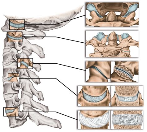 facet joint pain  spine surgery texas  institute