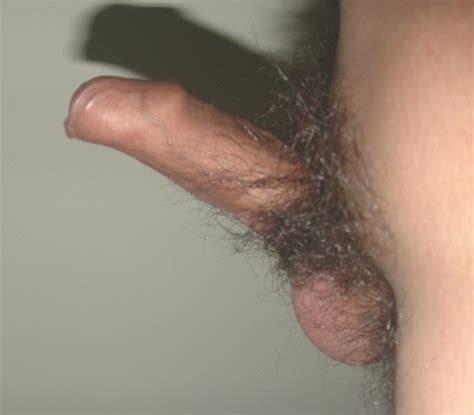 shave private part rash for s mega porn pics
