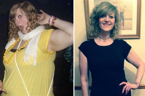 Extreme Slimmer Lost 11 Stone After Her Spine Popped Out Daily Star