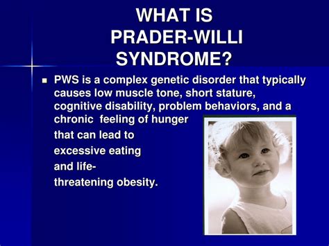 Ppt Living With Prader Willi Syndrome Powerpoint Presentation Free