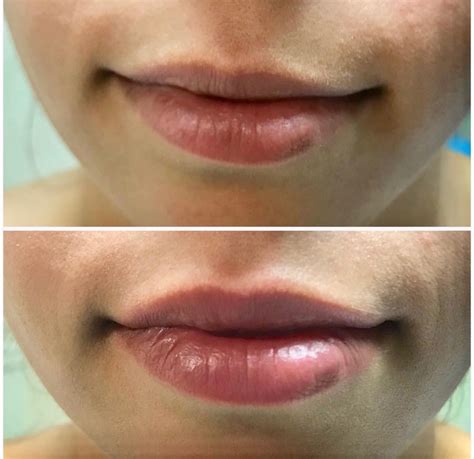 Brows Lashes And Lips — Simply Skin Laser Medispa