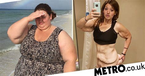 super slimmer who lost 21st reveals agony due to mounds of excess skin