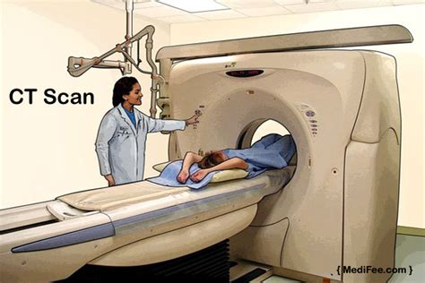 ct scan procedurecost