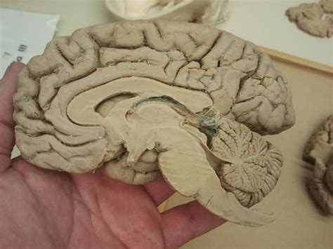 sagittal section  brain doccheck