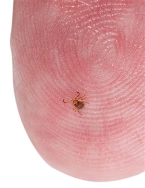 remove ticks  humans debugged