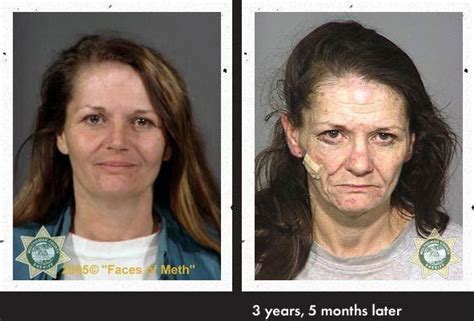 meth heads before and after gallery ebaum s world