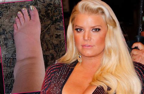 Pregnant Jessica Simpson Shocks Fans With Photo Of Swollen Foot