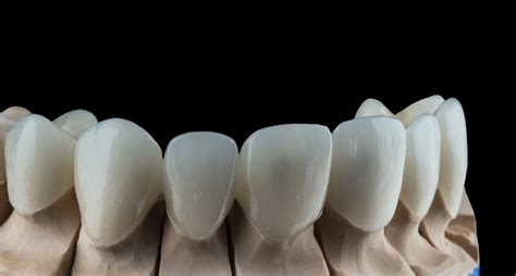 zirconia crown price  india affordable dental restorations