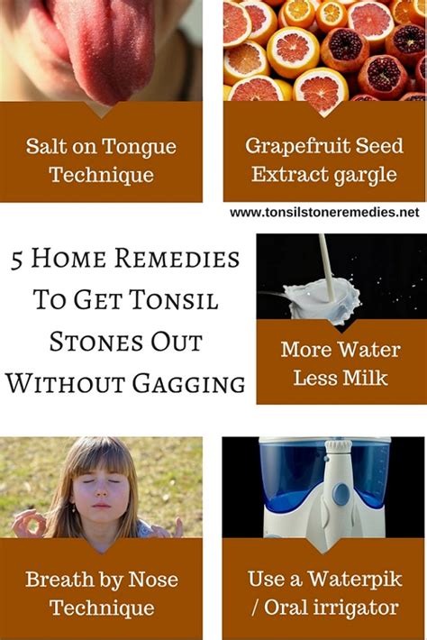 home remedies   tonsil stones   gagging gag reflex