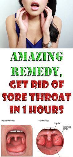 amazing remedy  rid  sore throat   hours health remedies throat drinks throat