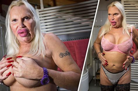 Transgender Woman Addicted To Cosmetic Surgery I Ve Spent £52k On