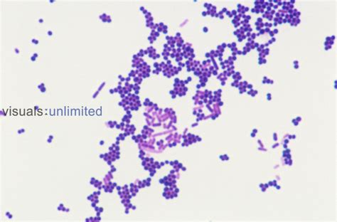 Escherichia Coli Or E Coli Visuals Unlimited