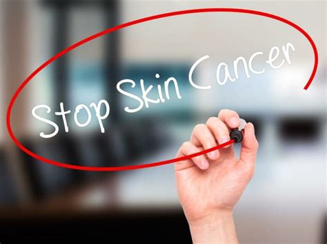common  rare varieties  skin cancer