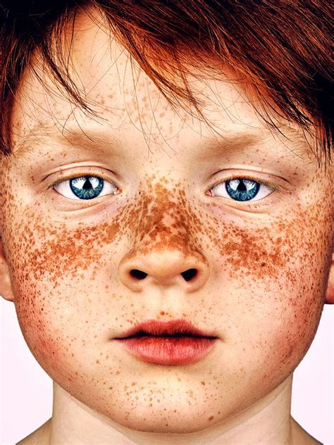 Stunning Beauty Of Freckled Individuals Freckles Portrait Beauty