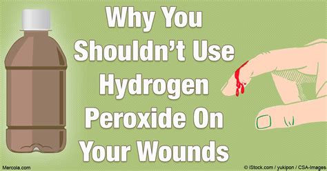hydrogen peroxide wounds ramsey nj patch