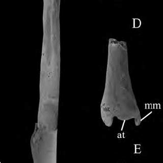 tibia fibula  apheliscus  posterior view   tibia fibula  scientific