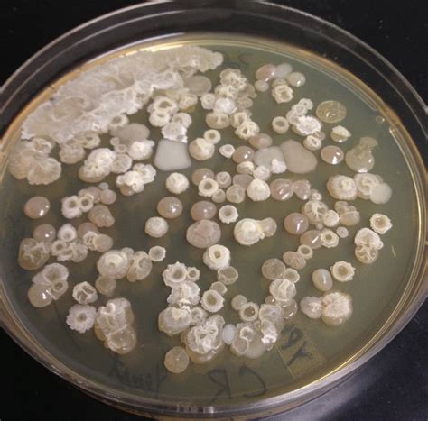 identify    based  colony morphology  post