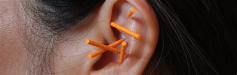 nada home ear acupuncture training healthcare professionals addiction