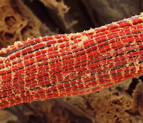 skeletal muscle fibres photograph  steve gschmeissner