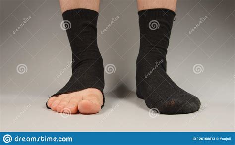 sock with a hole on the man`s legs front view stock